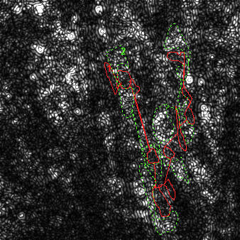 High Pass Filtered fluorescence