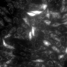 MitoSOX in stHDH cells