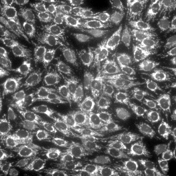 MitoTrackerDeep Red in stHDH cells