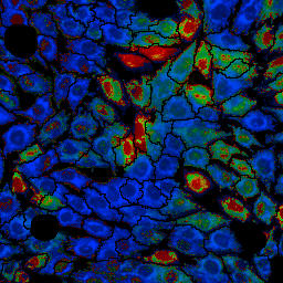 MitoSOX:MitoTracker Deep Red ratio image